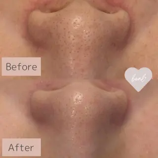 べアール所属・小顔/毛穴/ニキビ salon bealのエステ・リラクイメージ