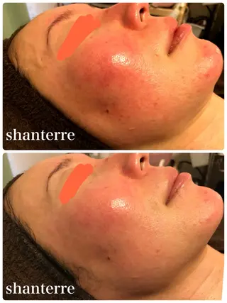 ピーリングサロン シャンテールのエステ・リラクイメージ