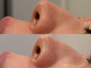 べアール所属・小顔/毛穴/ニキビ salon bealのその他イメージ