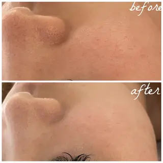 メンズ メナード岐阜市茜部 杉浦のエステ・リラクイメージ