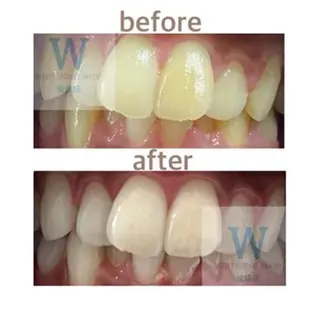 メンズ ホワイトニング ショップ船橋２号店のエステ・リラクイメージ