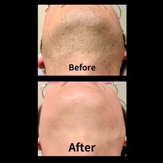 メンズ 脱毛サロン&ドライヘッドスパFIS 溝の口店所属・脱毛サロン FIS　溝の口店のエステ・リラクイメージ