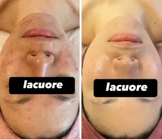 la   cuore所属・la   cuore 🌹ラ クオーレ🌹のエステ・リラクイメージ