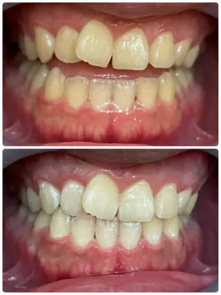 nail salon Na.(エヌエー)所属・nailsalon Na.のネイルデザイン