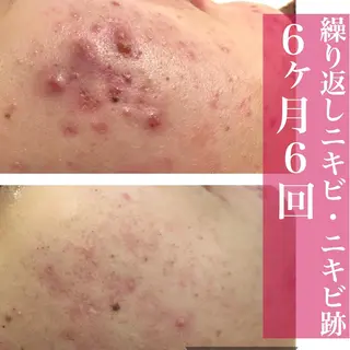 ミディアム カラー パーマ ヘアアレンジ メンズ ネイル マツエク・マツパ アイブロウ ニキビ・肌質改善専門 ♡人生が変わるサロンのエステ・リラクイメージ