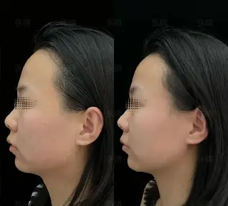 マツエク・マツパ aliaハイフ&水光ジェットサロン所属・aliaハーブ水光店 エステティシャン募集のエステ・リラクイメージ