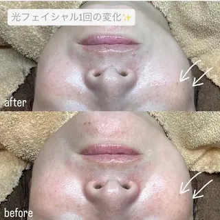 Rifuro 勝田台エステ所属・Rifuro勝田台 ララピール・毛穴洗浄のエステ・リラクイメージ