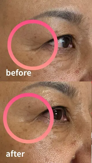 Total Beauty salon Bloom所属・肌育WISHpro 専門サロンBloomのエステ・リラクイメージ