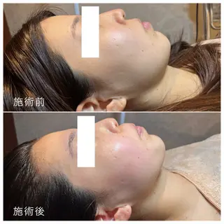 La Dusa 韓国肌管理/小波のエステ・リラクイメージ