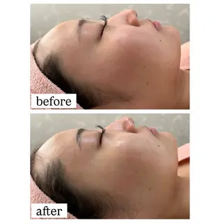 ハイパーナイフ専門店　Salon de COCO所属・Salon de COCOのエステ・リラクイメージ