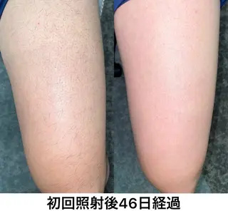 グレイスフルルーム所属・【本格脱毛】 グレイスフルルームのエステ・リラクイメージ