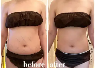 【大名】 NicoLのエステ・リラクイメージ