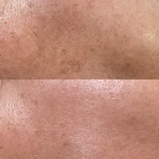 brilliance所属・老化肌トラブル肌専門 Brillianceのエステ・リラクイメージ