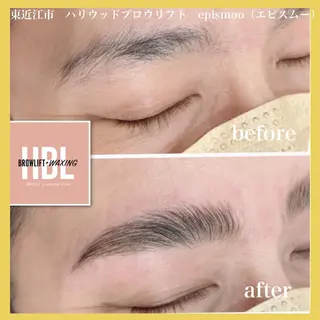 アイブロウ epismoo 脱毛/HBL/毛穴の眉毛・アイブロウイメージ