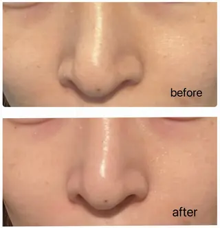 韓国肌管理★ 聖のエステ・リラクイメージ