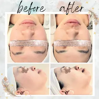 NARIS beautysalon 所属・Takahashi  Hiromiのエステ・リラクイメージ