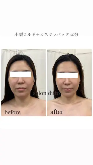 salon ditto所属・mio (小顔・ヘッドスパ)のエステ・リラクイメージ