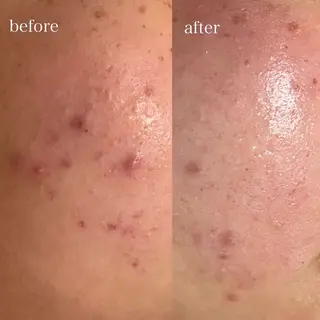 、 、‪‪のエステ・リラクイメージ