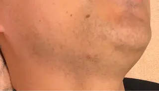 POPOのエステ所属・popoのエステ arisaのエステ・リラクイメージ