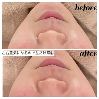 【ニキビ/肌管理】 salon varyのエステ・リラクイメージ