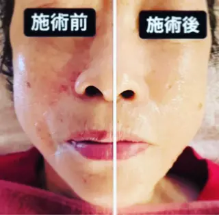 古民家サロン Berry大塚由貴のエステ・リラクイメージ