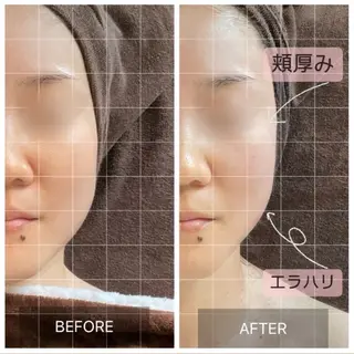 MIRAI小顔 名古屋店のエステ・リラクイメージ