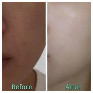 🅖🅤🅩🅔🅛 salonのエステ・リラクイメージ