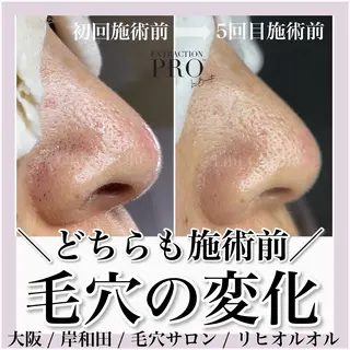 毛穴汚れ改善専門店/ 岸和田/リヒオルオルのエステ・リラクイメージ