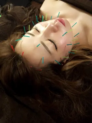 美容鍼灸サロンYOSHINO所属・美容鍼灸サロン YOSHINOのエステ・リラクイメージ