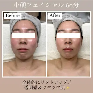 Beautysalon YURA所属・リンパ＆小顔美肌 YURA/Ayakaのエステ・リラクイメージ