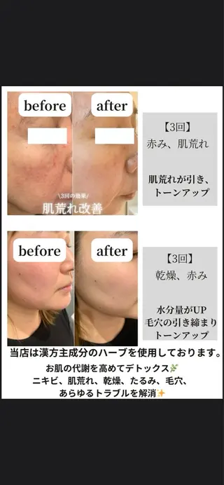 cherir所属・cherir大井町/ 毛穴ニキビ改善専門のエステ・リラクイメージ