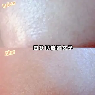 Hit. シュガーリング豊橋のエステ・リラクイメージ