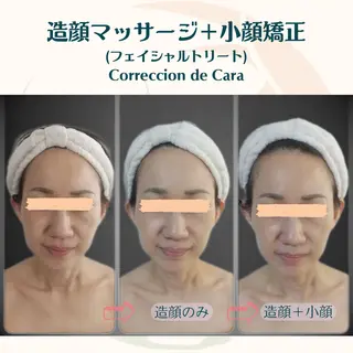 小顔矯正☀︎バスト ☀︎ハルのエステ・リラクイメージ