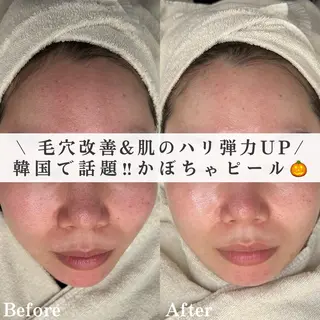 韓国肌管理&小顔 ＩＲＯＨＡのエステ・リラクイメージ