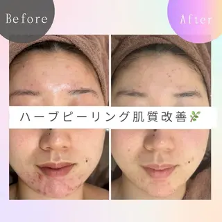 WHITE AQUA 🌼柏店のエステ・リラクイメージ