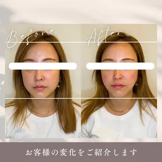 小顔矯正&美容整体 整え屋REDのエステ・リラクイメージ