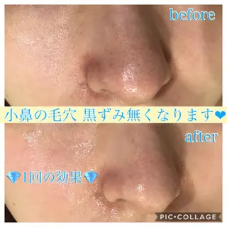 セミロング カラー パーマ ヘアアレンジ キッズ ネイル マツエク・マツパ Ensor Clair所属・EnsorClair 代表　野口真央のエステ・リラクイメージ