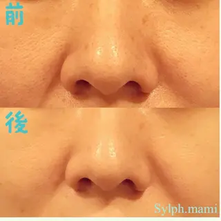 毒素出し専門サロンSylph(なかがわ整骨院併設サロン)所属・Mami Hataのエステ・リラクイメージ