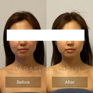 onnitete所属・onnitete PARAFUSEのエステ・リラクイメージ