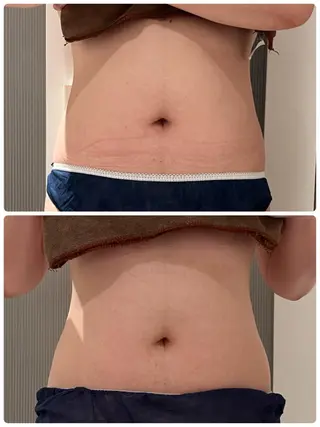 Folche所属・Folcheはません 森山のエステ・リラクイメージ