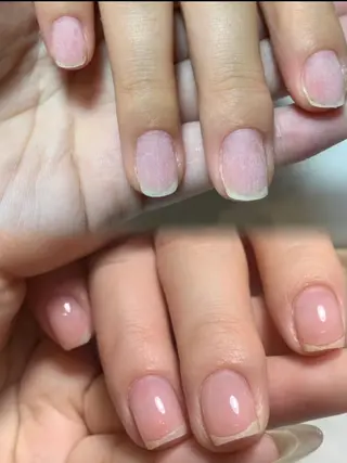 ネイル ネイリストゆか💅 長さだし、深爪矯正のネイルデザイン