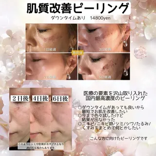 Liber【リベル】 AYAKAのエステ・リラクイメージ