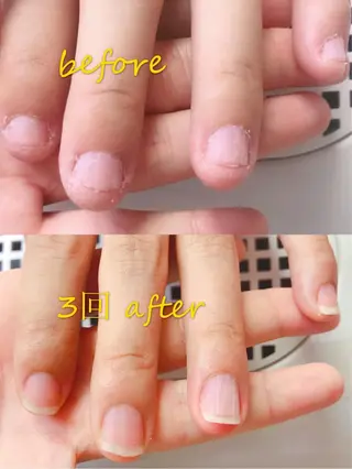 カラー ネイル Q Free nailsのネイルデザイン