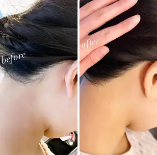 うなじ脱毛/美肌脱毛 LABELのエステ・リラクイメージ