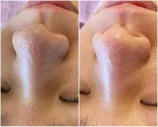 Lila プライベートサロンのエステ・リラクイメージ