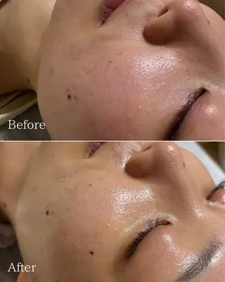 エステと焼き菓子 レモンバームソワンのエステ・リラクイメージ