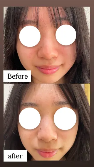 Beautysalon  R's所属・栗本 瞳のエステ・リラクイメージ