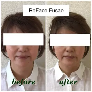 小顔矯正サロン　ReFace Fusae（リフェイスフサエ）所属・小顔矯正サロン リフェイスフサエのエステ・リラクイメージ