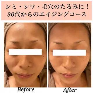 Bellesthe （ベルエステ）のエステ・リラクイメージ