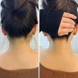 うなじ脱毛/美肌脱毛 LABELのエステ・リラクイメージ